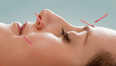 Image for Follow up Aesthetic / Cosmetic Acupuncture with LED Therapy