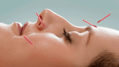 Image for Initial Aesthetic / Cosmetic Acupuncture Treatment with LED Therapy